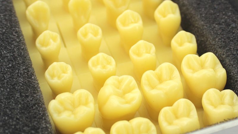 深覆合矫正：牙套矫正过程中的脸型变化解析